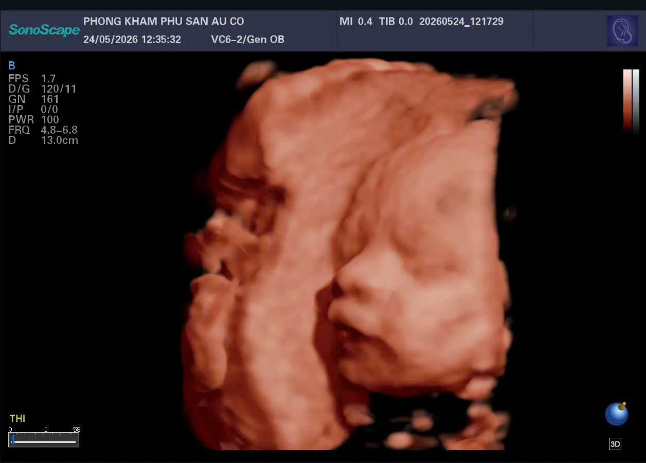 Phòng khám Phụ Sản IVF Âu Cơ - BS Trần Minh Quang Bệnh Viện Từ Dũ 3